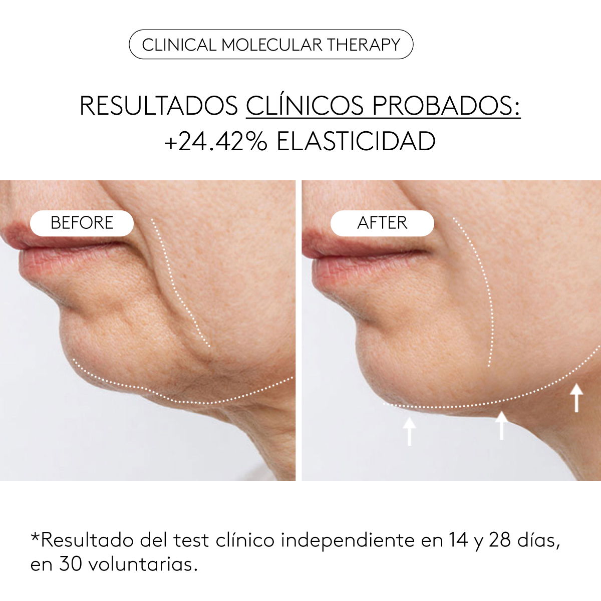 FIRMEZA CLÍNICA TOTAL 9