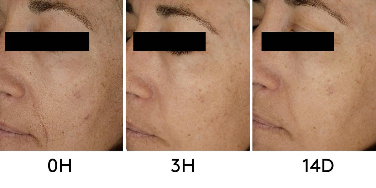 CLINICAL BEAUTY FILLER | 2 MESES