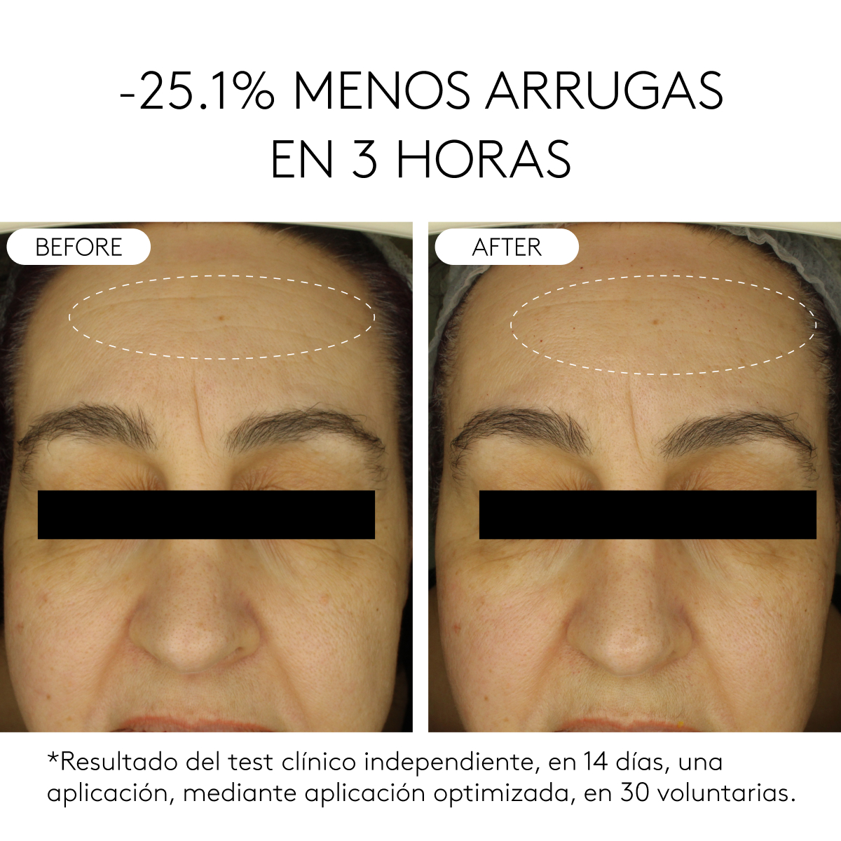 CLINICAL BEAUTY FILLER | 2 MESES detail 2