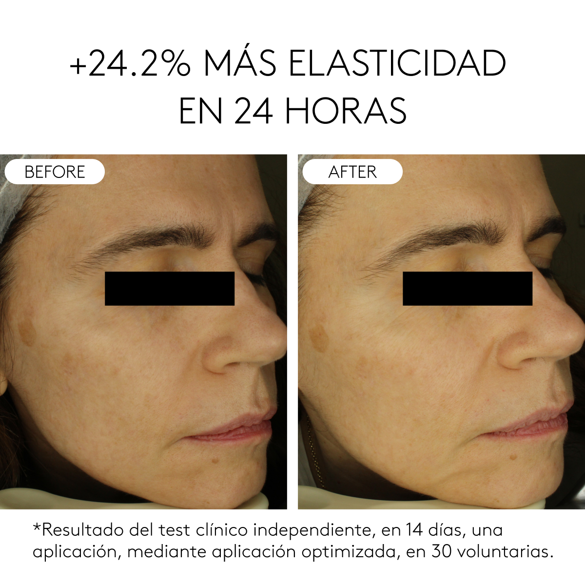 CLINICAL BEAUTY FILLER | 2 MESES detail 4