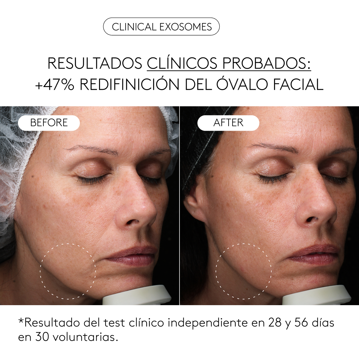 FIRMEZA CLÍNICA TOTAL detail 4