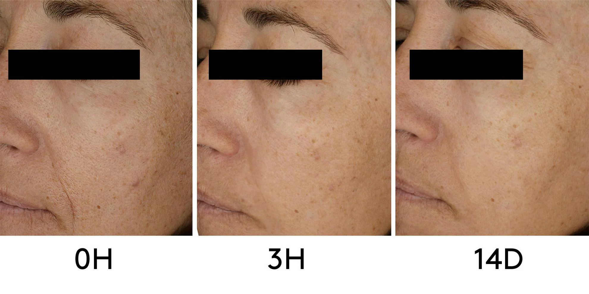 CLINICAL BEAUTY FILLER | 2 MESES